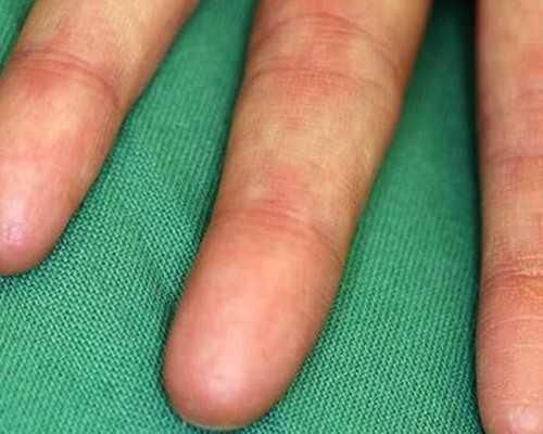 2024年试管婴儿费用医保报销政策解析与医院选择指南