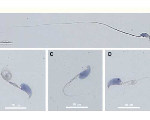 济南试管婴儿医院排名与选择指南：哪家医院更专业？