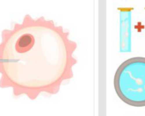 济南供卵生男孩费用 影响济南山大生殖医院供精试管费用的因素 ‘三维超声怎