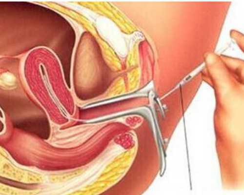 2024年正规民营供卵机构排名前七更新与试管代怀男宝指南