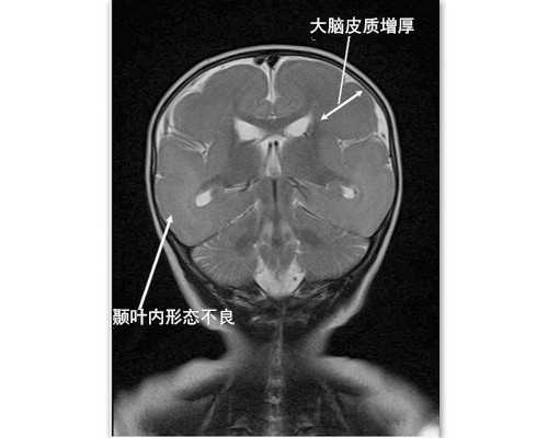 权威生殖医院与专家解析，助孕技术全指南